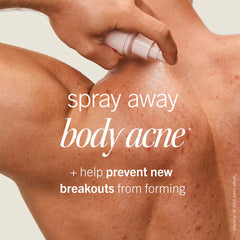 Ultimate Acne Solutions Routine