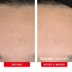 Face-Firming Duo